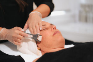 Skin Needling