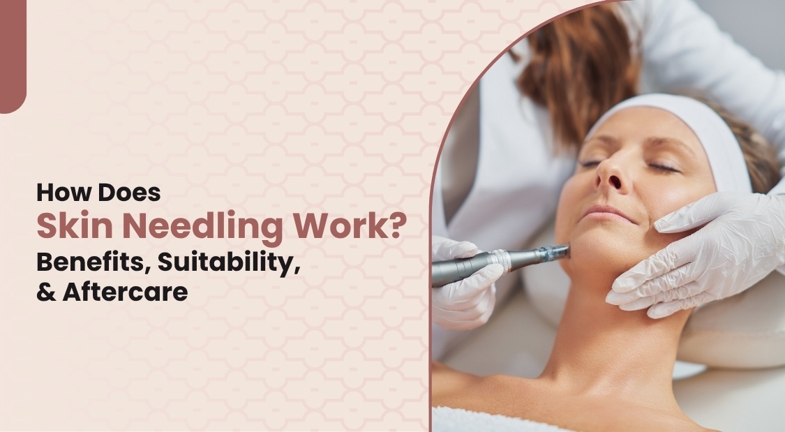 How Does Skin Needling Work? Benefits, Suitability, & Aftercare