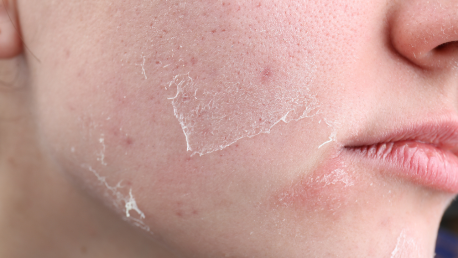 how often should you get a facial